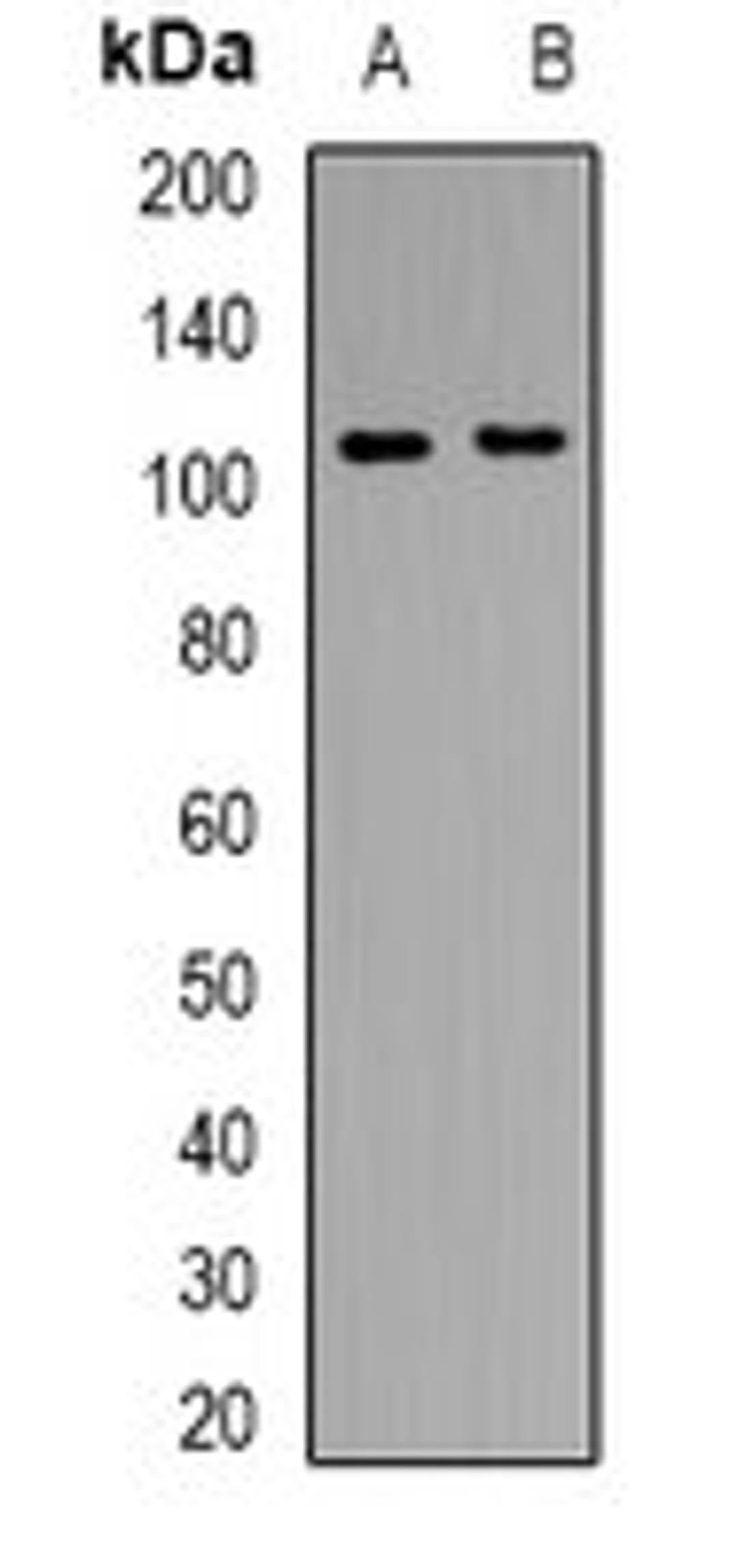 Western blot analysis of THP1 (Lane 1), mouse brain (Lane 2) whole cell lysates using CD13 antibody