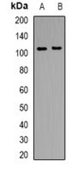 Western blot analysis of THP1 (Lane 1), mouse brain (Lane 2) whole cell lysates using CD13 antibody