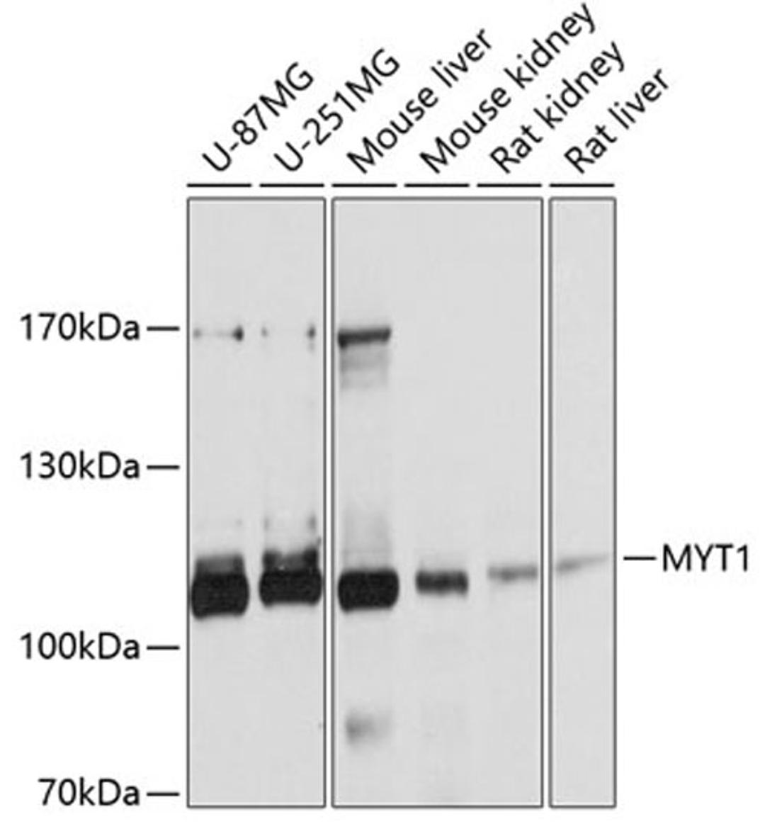 Western blot - MYT1 antibody (A10824)