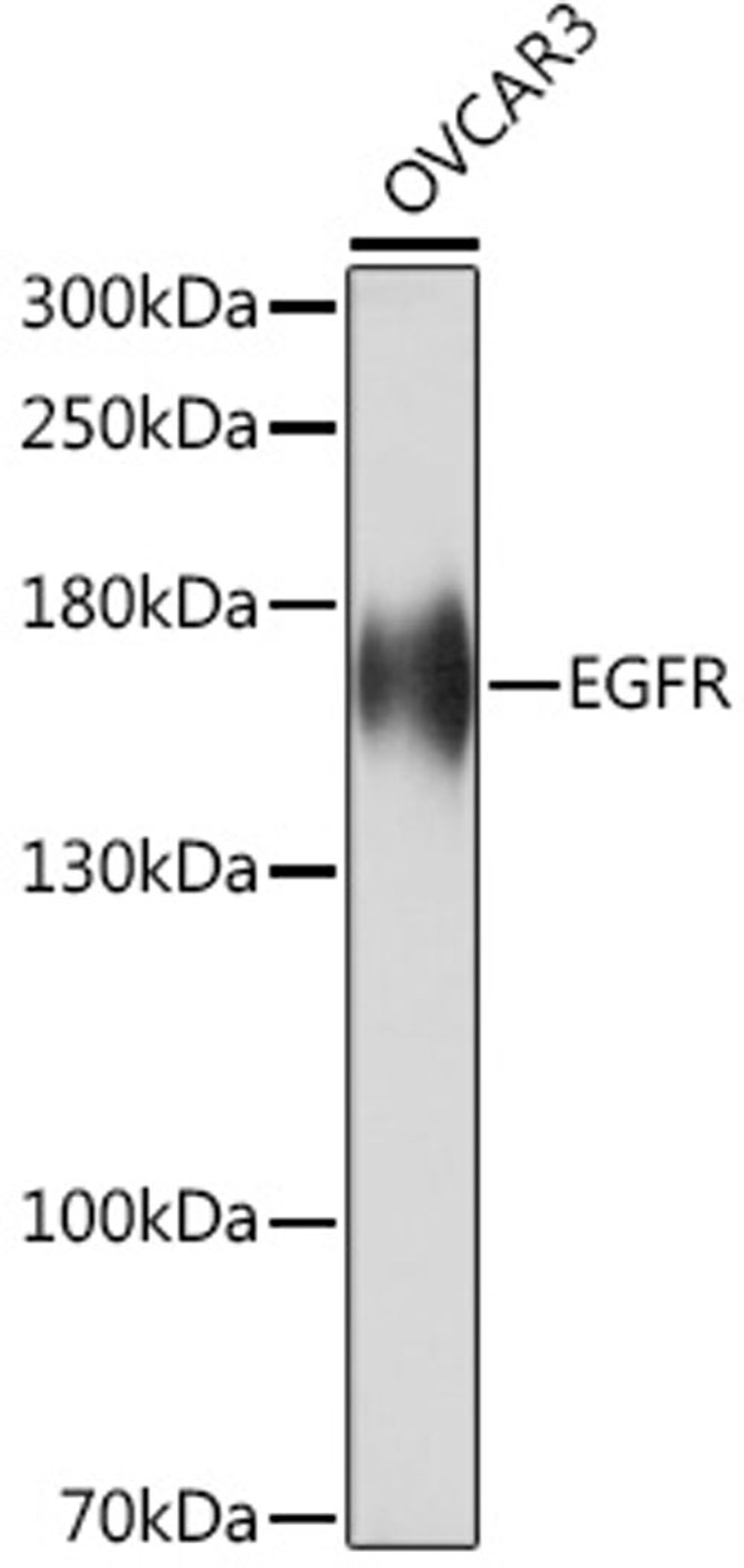 Western blot - EGFR Rabbit pAb (A16840)