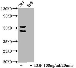 Western Blot. Positive WB detected in 293 whole cell lysate(treated with EGF or not). All lanes Phospho-MAPK8/MAPK9/MAPK10 antibody at 1.65μg/ml. Secondary. Goat polyclonal to rabbit IgG at 1/50000 dilution. Predicted band size: 46,54 KDa. Observed band size: 46,54 KDa.
