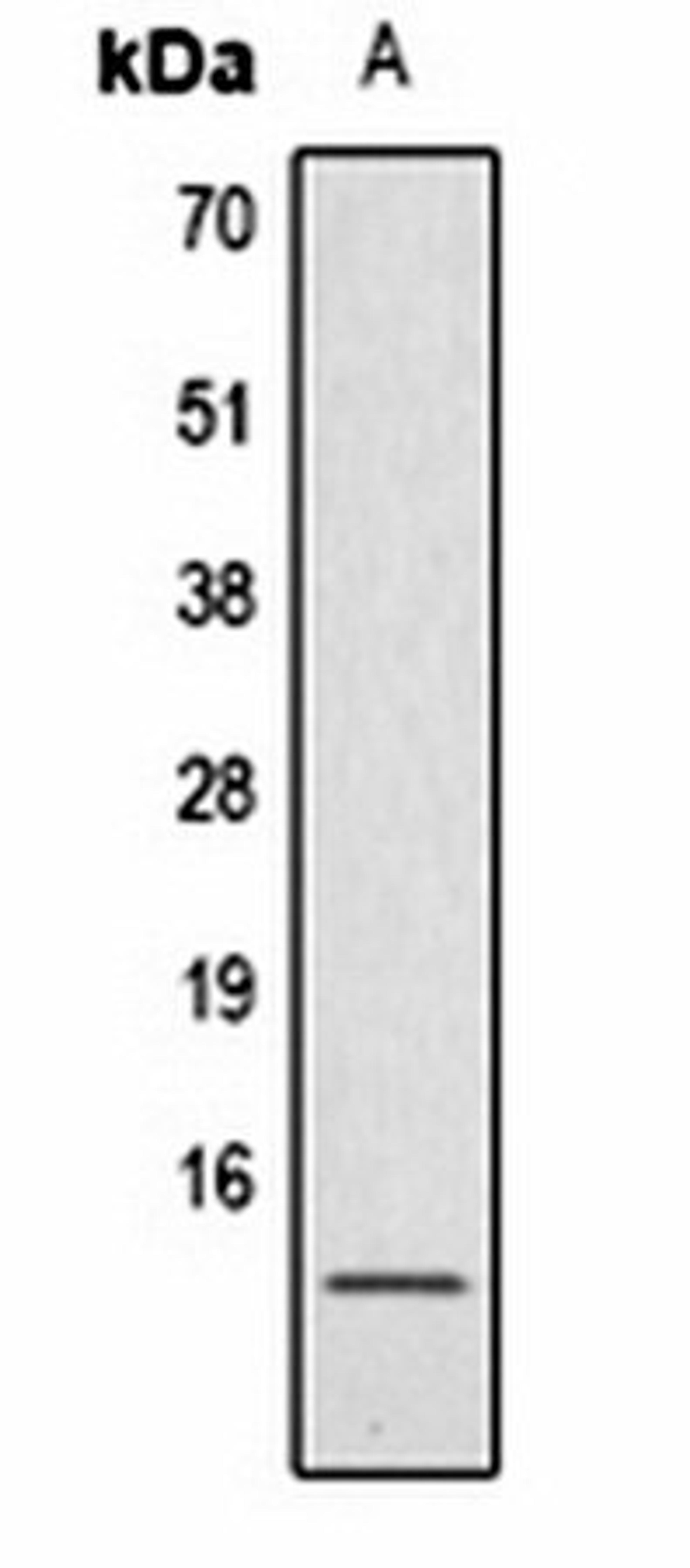 Western blot analysis of  Hela TSA-treated (Lane1) whole cell lysates using Histone H4 (AcK91) antibody