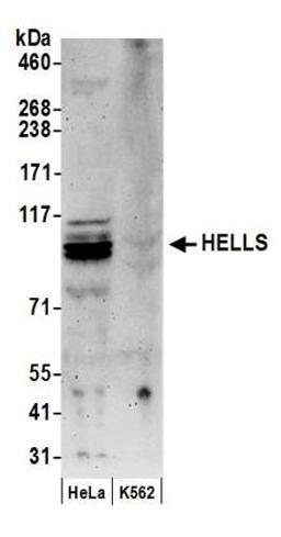 Detection of human HELLS by western blot.