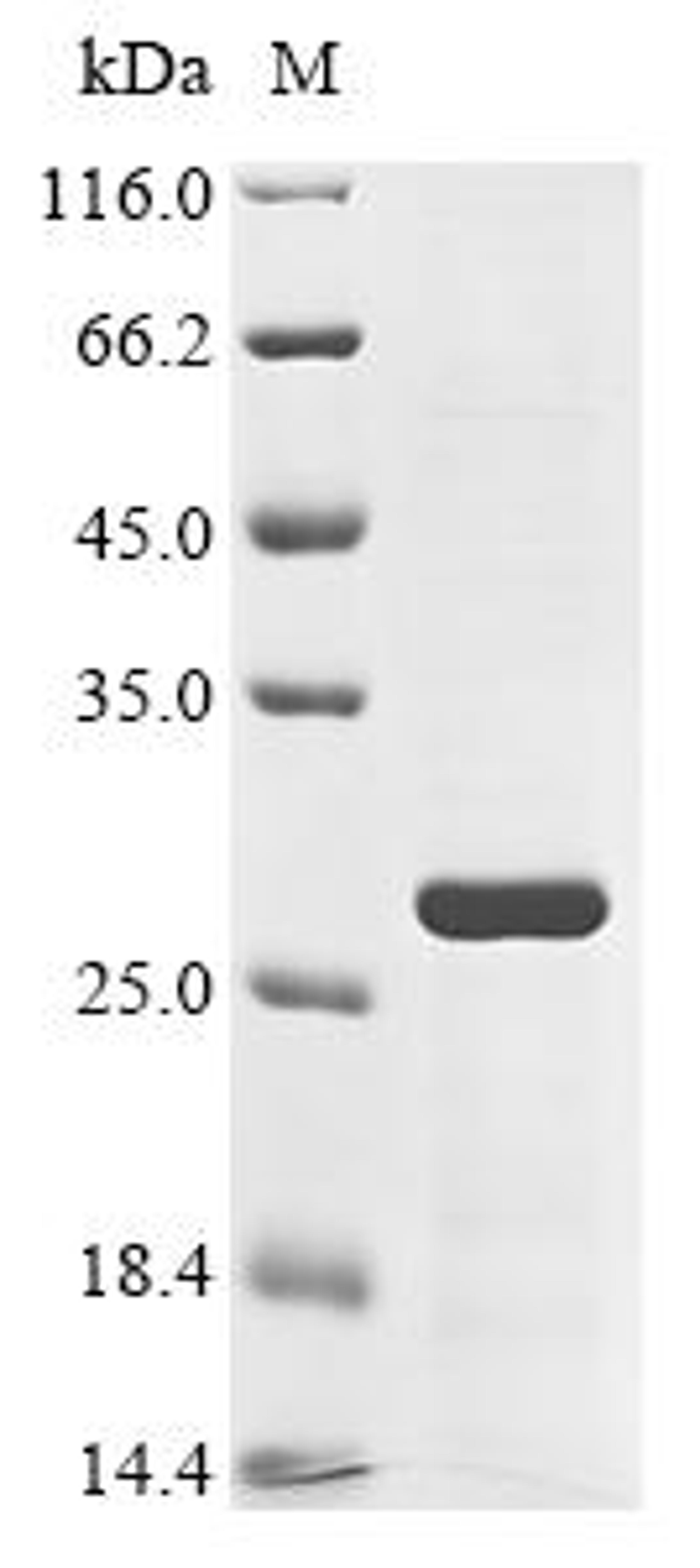 (Tris-Glycine gel) Discontinuous SDS-PAGE (reduced) with 5% enrichment gel and 15% separation gel.