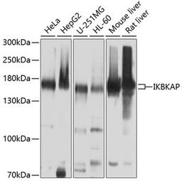 Western blot - IKBKAP antibody (A10127)