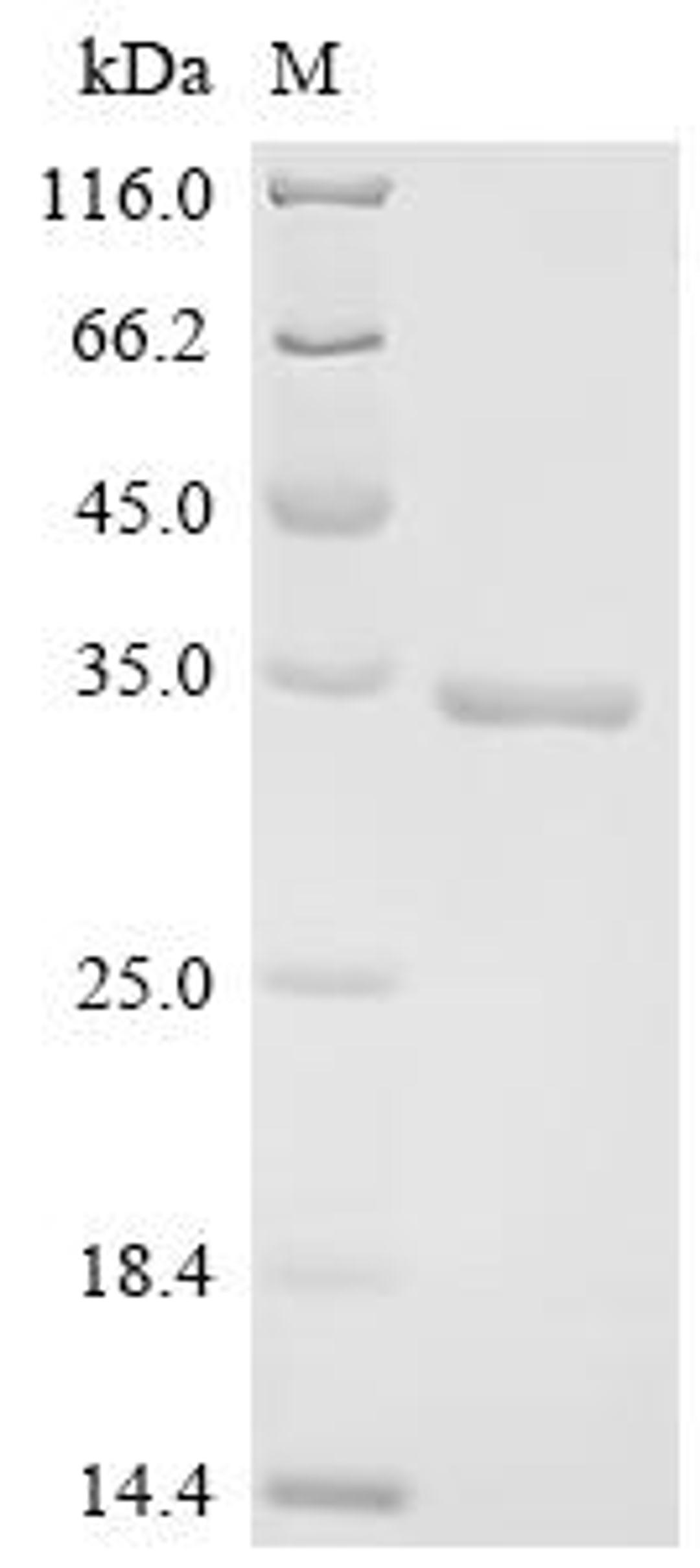 (Tris-Glycine gel) Discontinuous SDS-PAGE (reduced) with 5% enrichment gel and 15% separation gel.