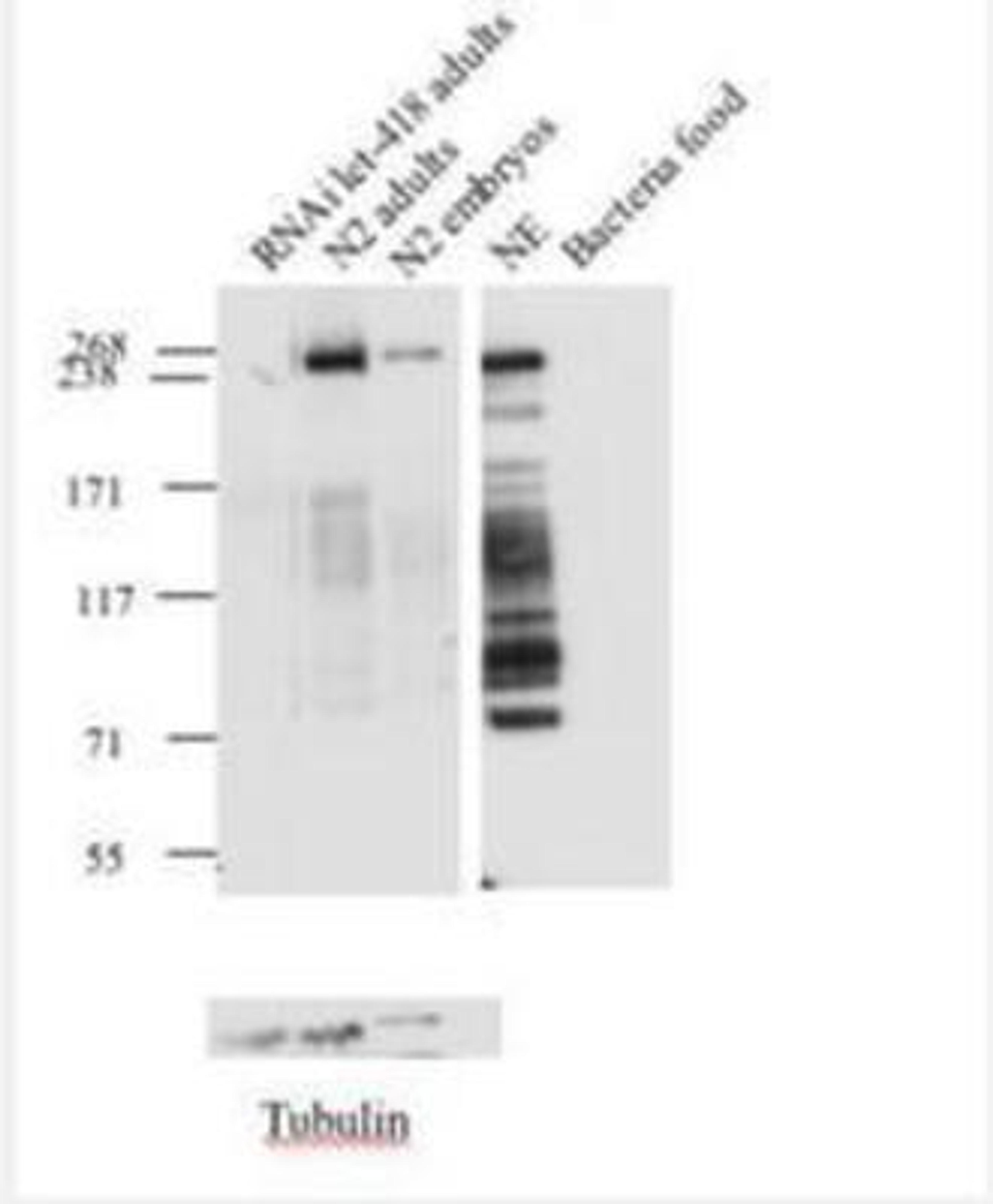 Western Blot: LET-418 Antibody [38640002] This image is specific to animal number SDQ2339 Some protein products degradations. Use proteinases inhibitors dilution: 1:10 000