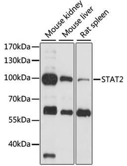 Western blot - STAT2 antibody (A14995)