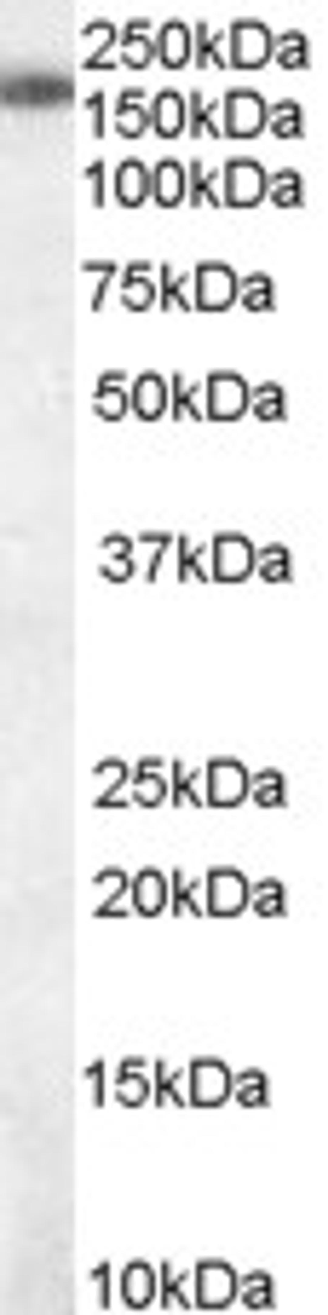 46-338 staining (0.01ug/ml) of Jurkat cell lysate (RIPA buffer, 30ug total protein per lane). Primary incubated for 1 hour. Detected by chemiluminescence.