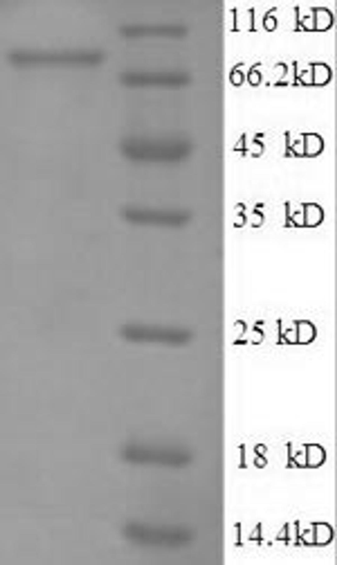 (Tris-Glycine gel) Discontinuous SDS-PAGE (reduced) with 5% enrichment gel and 15% separation gel.