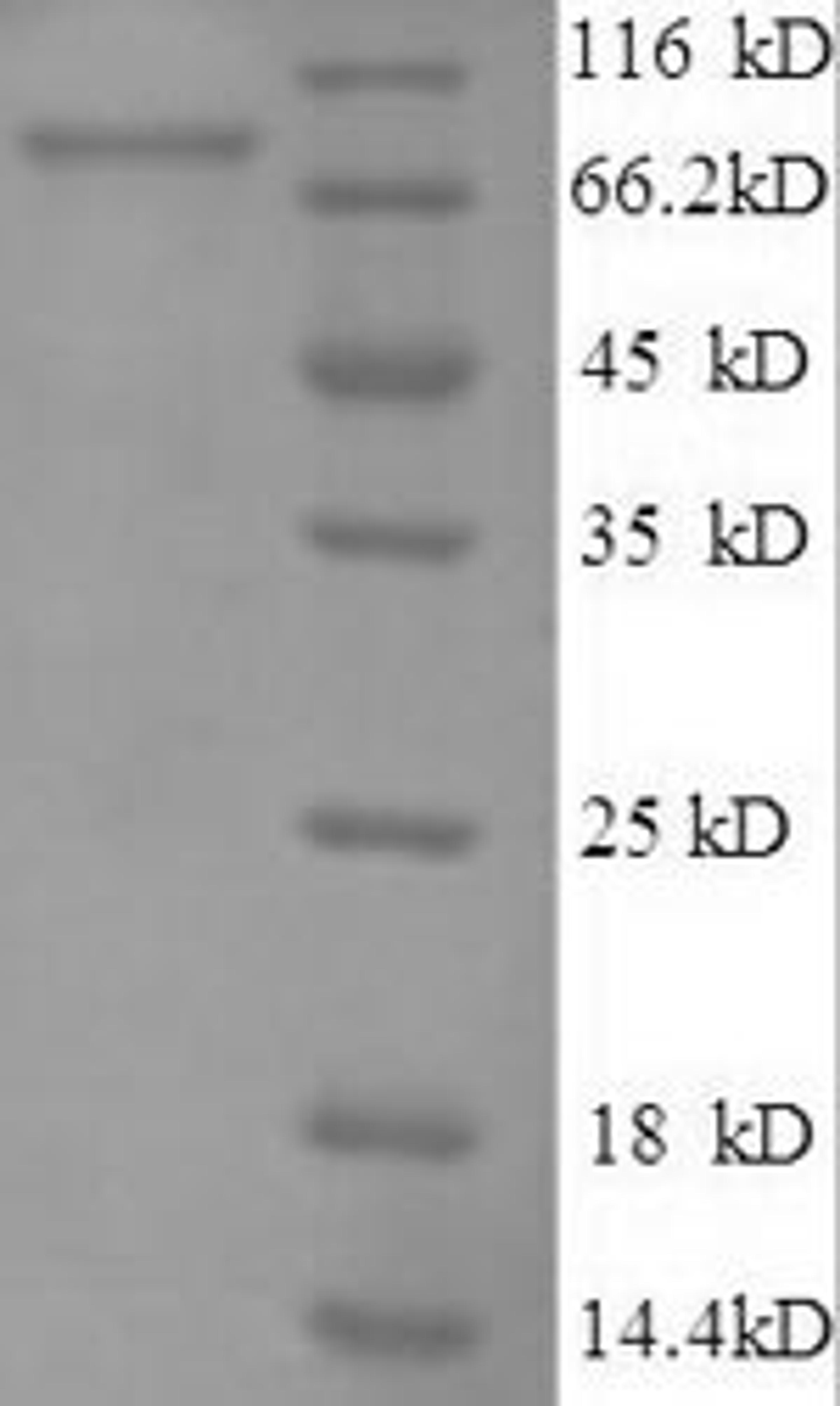(Tris-Glycine gel) Discontinuous SDS-PAGE (reduced) with 5% enrichment gel and 15% separation gel.