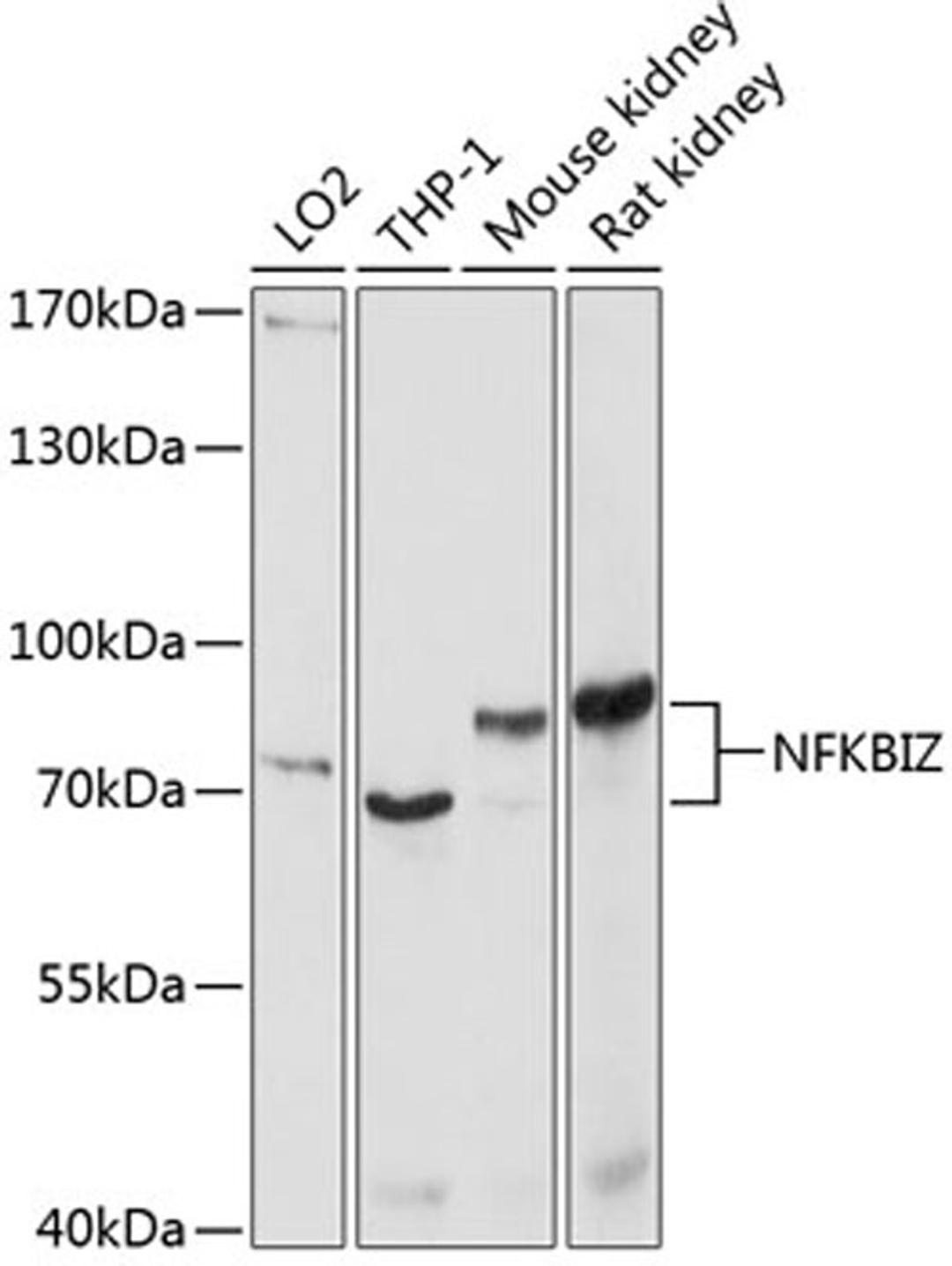 Western blot - NFKBIZ antibody (A10492)