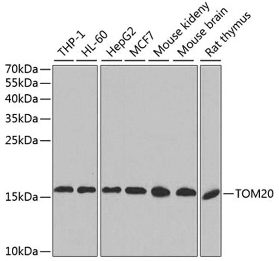 Western blot - TOM20 antibody (A6774)