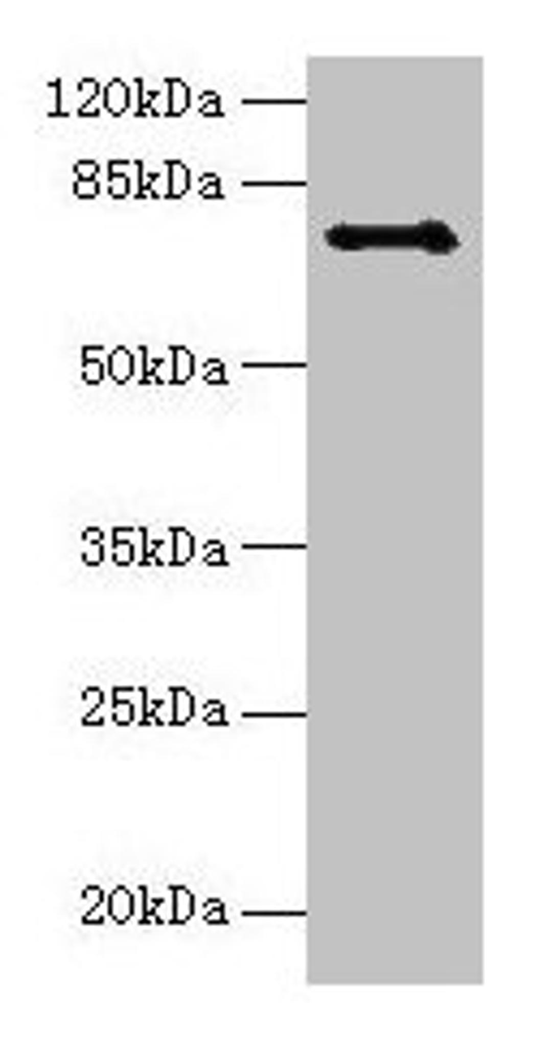 Western blot. All lanes: Ctcfl antibody at 6µg/ml + Hela whole cell lysate. Secondary. Goat polyclonal to rabbit IgG at 1/10000 dilution. Predicted band size: 74, 75 kDa. Observed band size: 74 kDa