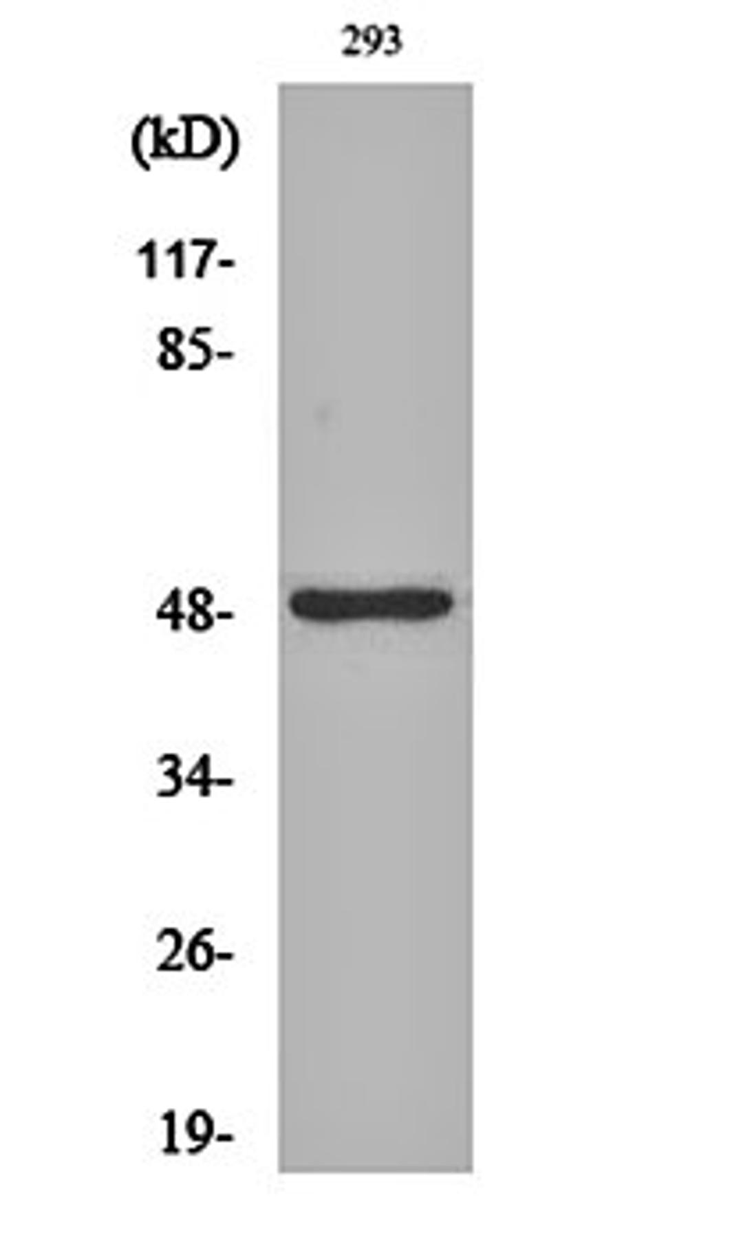 Western blot analysis of 293 cell lysates using Neuro D2 antibody