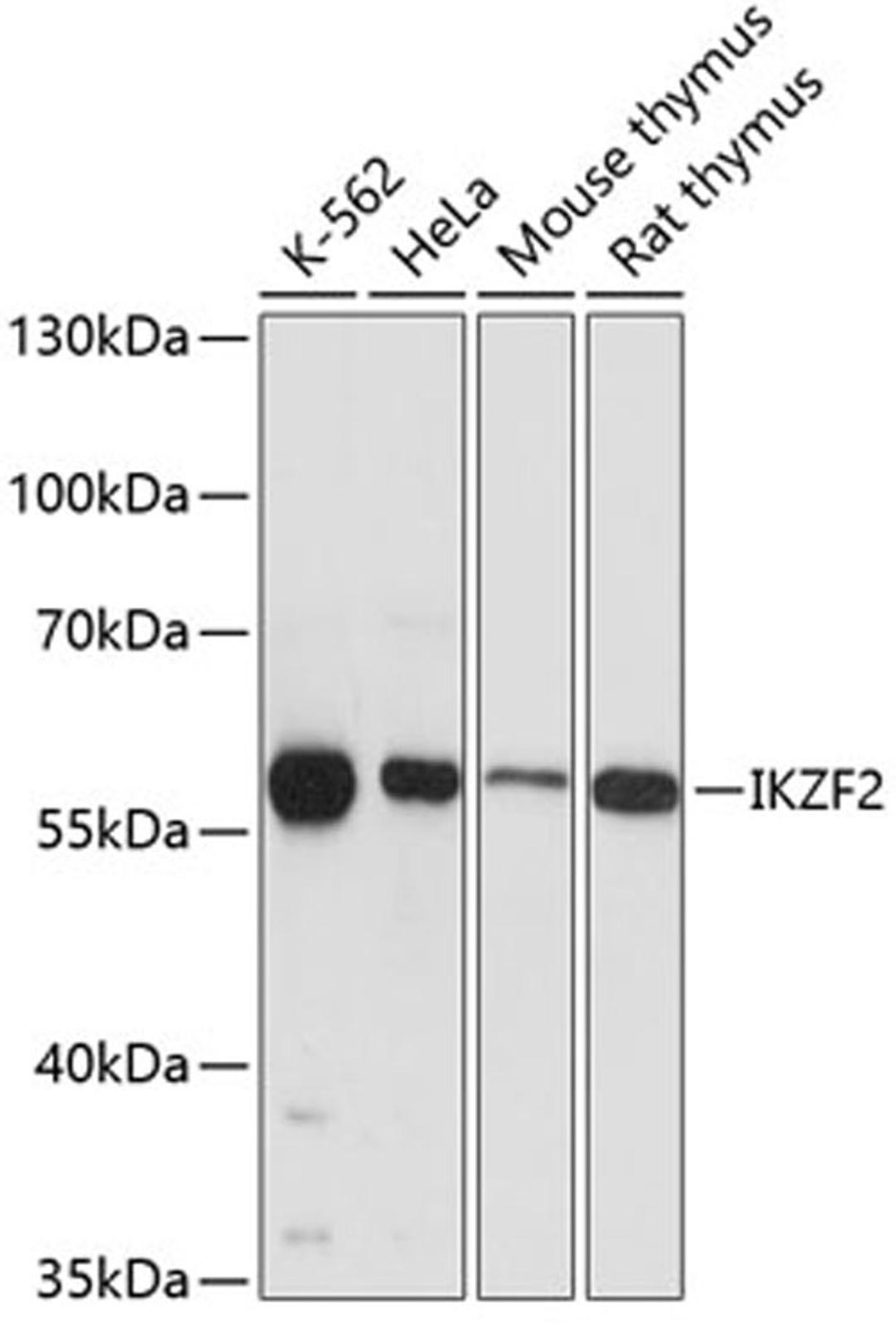 Western blot - IKZF2 antibody (A12265)