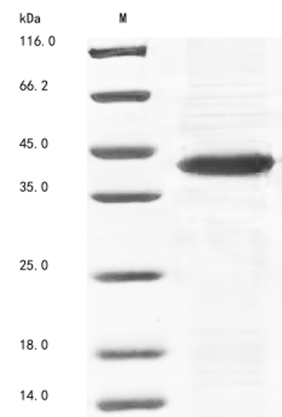 (Tris-Glycine gel) Discontinuous SDS-PAGE (reduced) with 5% enrichment gel and 15% separation gel.