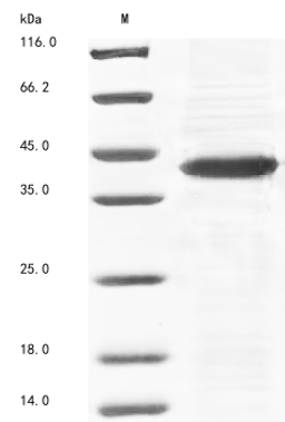 (Tris-Glycine gel) Discontinuous SDS-PAGE (reduced) with 5% enrichment gel and 15% separation gel.