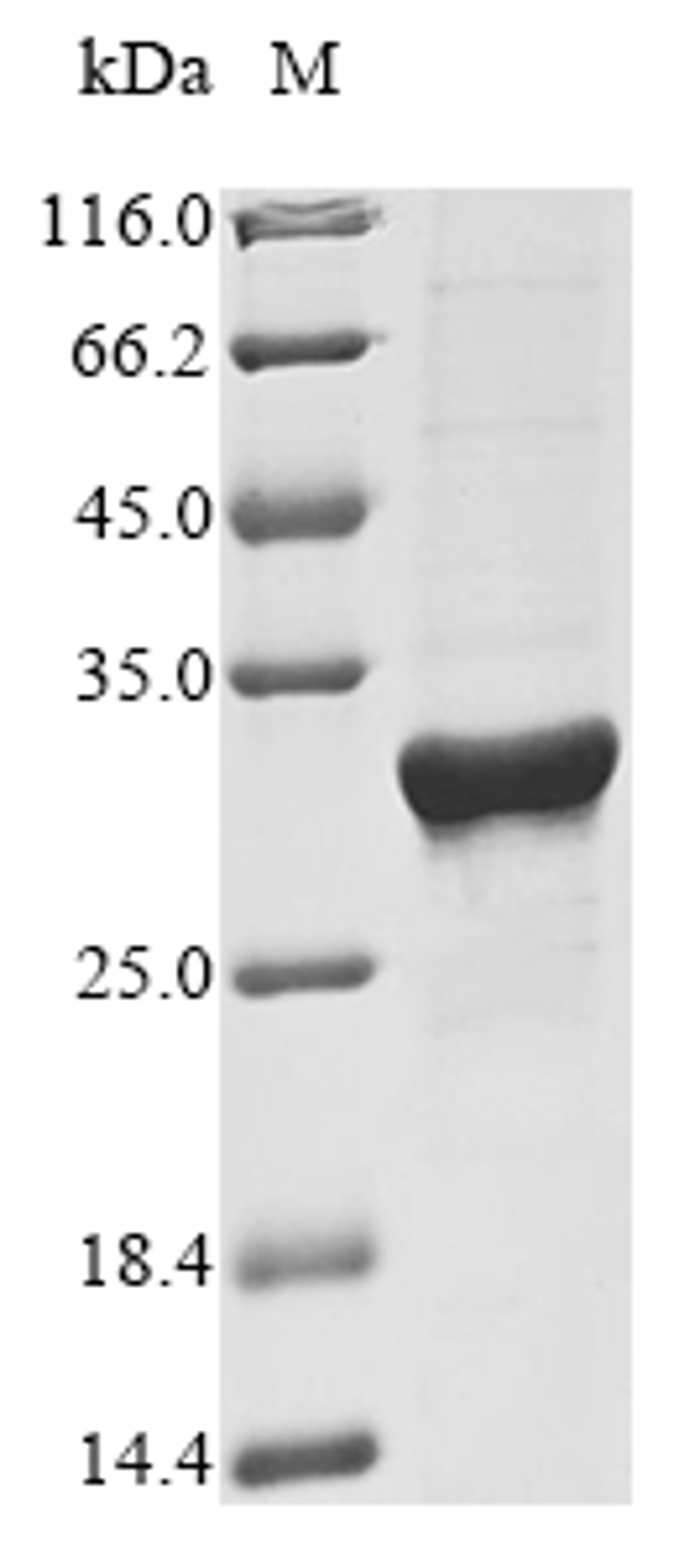 (Tris-Glycine gel) Discontinuous SDS-PAGE (reduced) with 5% enrichment gel and 15% separation gel.