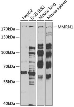 Western blot - MMRN1 Antibody (A6658)