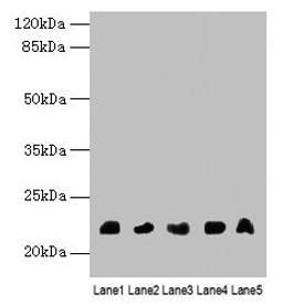 Western blot. All lanes: NRSN1 antibody at 3µg/ml. Lane 1: Mouse stomach tissue. Lane 2: Mouse kidney tissue. Lane 3: Mouse thymus tissue. Lane 4: Hela whole cell lysate. Lane 5: 293T whole cell lysate. Secondary. Goat polyclonal to rabbit IgG at 1/10000 dilution. Predicted band size: 22 kDa. Observed band size: 22 kDa