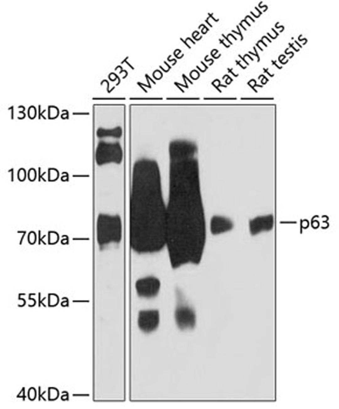 Western blot - p63 antibody (A12968)