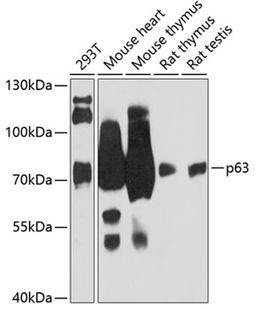 Western blot - p63 antibody (A12968)