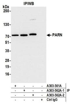 Detection of human PARN by western blot of immunoprecipitates.