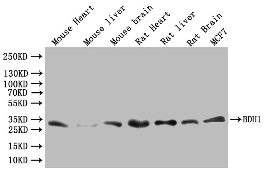Western blot. All lanes: BDH1 antibody at 2.4µg/ml. Lane 1: HepG2 whole cell lysate. Lane 2: Mouse liver tissue. Lane 3: Mouse kidney tissue. Lane 4: Mouse brain tissue. Secondary. Goat polyclonal to rabbit IgG at 1/10000 dilution. Predicted band size: 39 kDa. Observed band size: 39 kDa