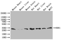 Western blot. All lanes: BDH1 antibody at 2.4µg/ml. Lane 1: HepG2 whole cell lysate. Lane 2: Mouse liver tissue. Lane 3: Mouse kidney tissue. Lane 4: Mouse brain tissue. Secondary. Goat polyclonal to rabbit IgG at 1/10000 dilution. Predicted band size: 39 kDa. Observed band size: 39 kDa
