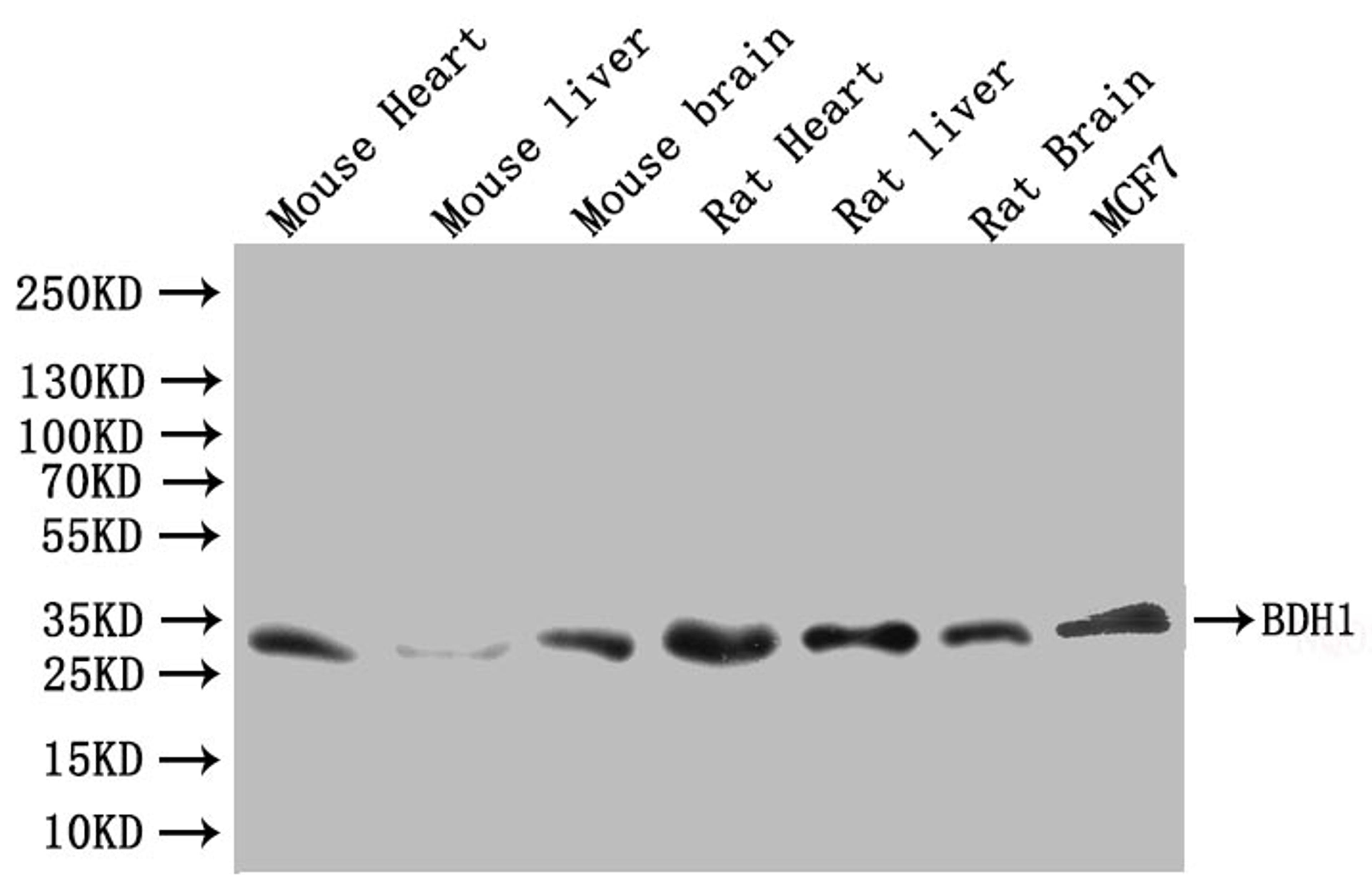 Western blot. All lanes: BDH1 antibody at 2.4µg/ml. Lane 1: HepG2 whole cell lysate. Lane 2: Mouse liver tissue. Lane 3: Mouse kidney tissue. Lane 4: Mouse brain tissue. Secondary. Goat polyclonal to rabbit IgG at 1/10000 dilution. Predicted band size: 39 kDa. Observed band size: 39 kDa