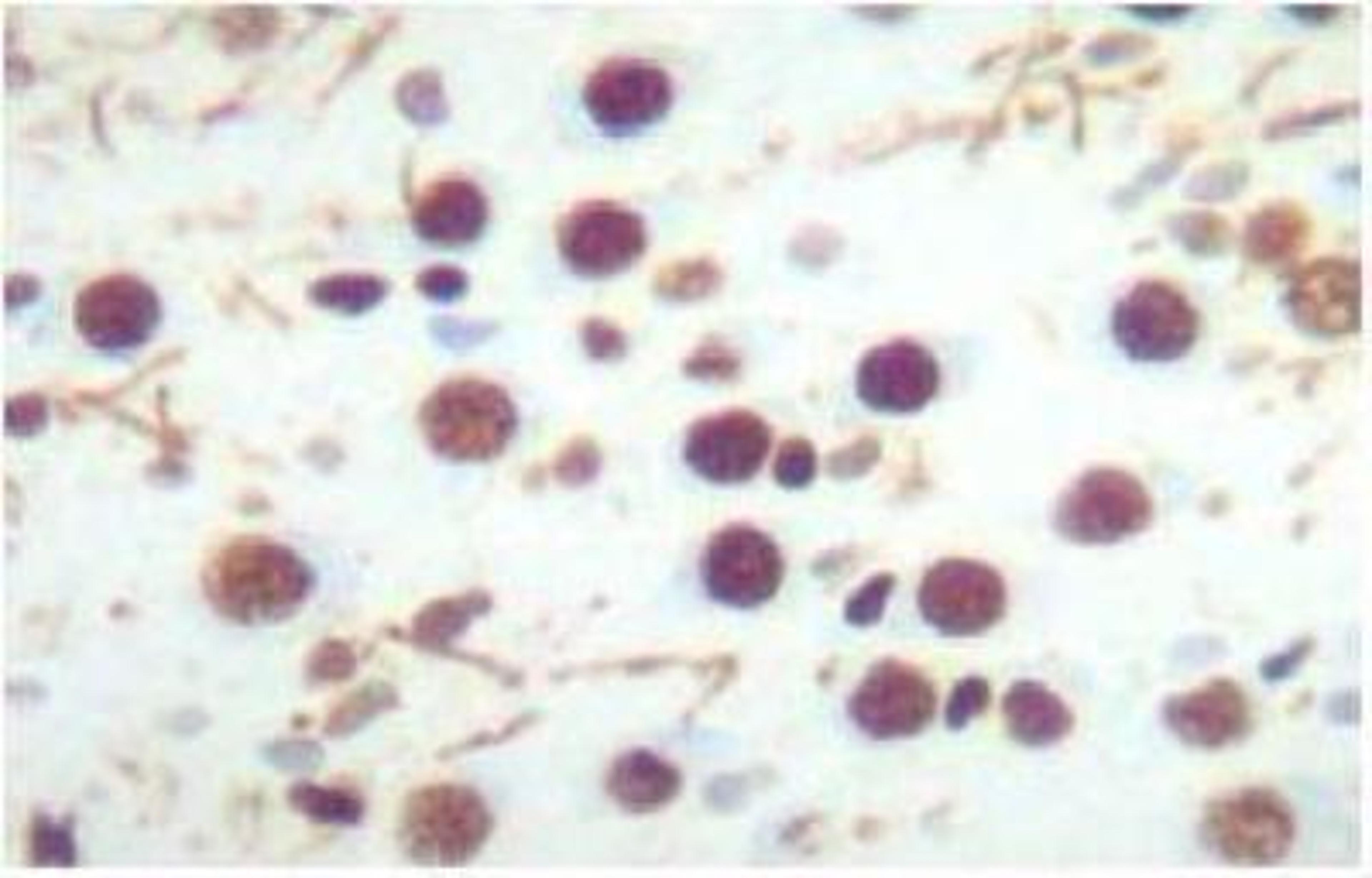 Immunohistochemistry: CREB [p Ser133] Antibody [NB300-273] - Immunostaining of cultured rat hippocampal slices showing nuclear labeling of CREB phosphorylated at Ser133 in brown.