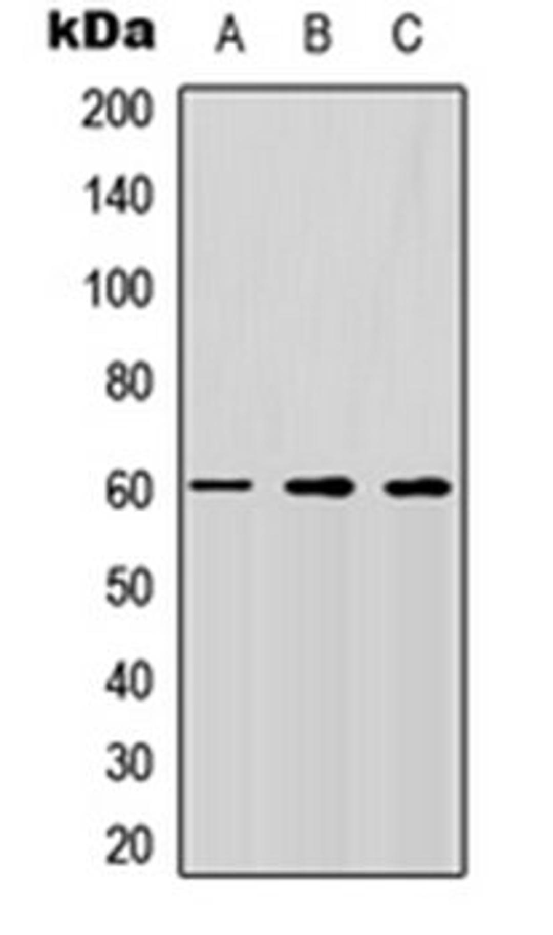 Western blot analysis of HEK293T (Lane 1), Raw264.7 (Lane 2), H9C2 (Lane 3) whole cell lysates using CD292 antibody