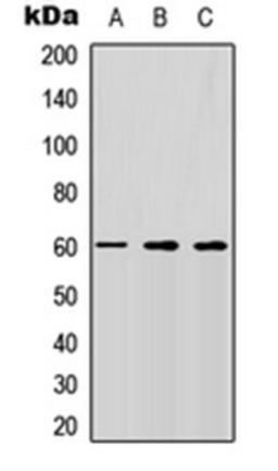 Western blot analysis of HEK293T (Lane 1), Raw264.7 (Lane 2), H9C2 (Lane 3) whole cell lysates using CD292 antibody