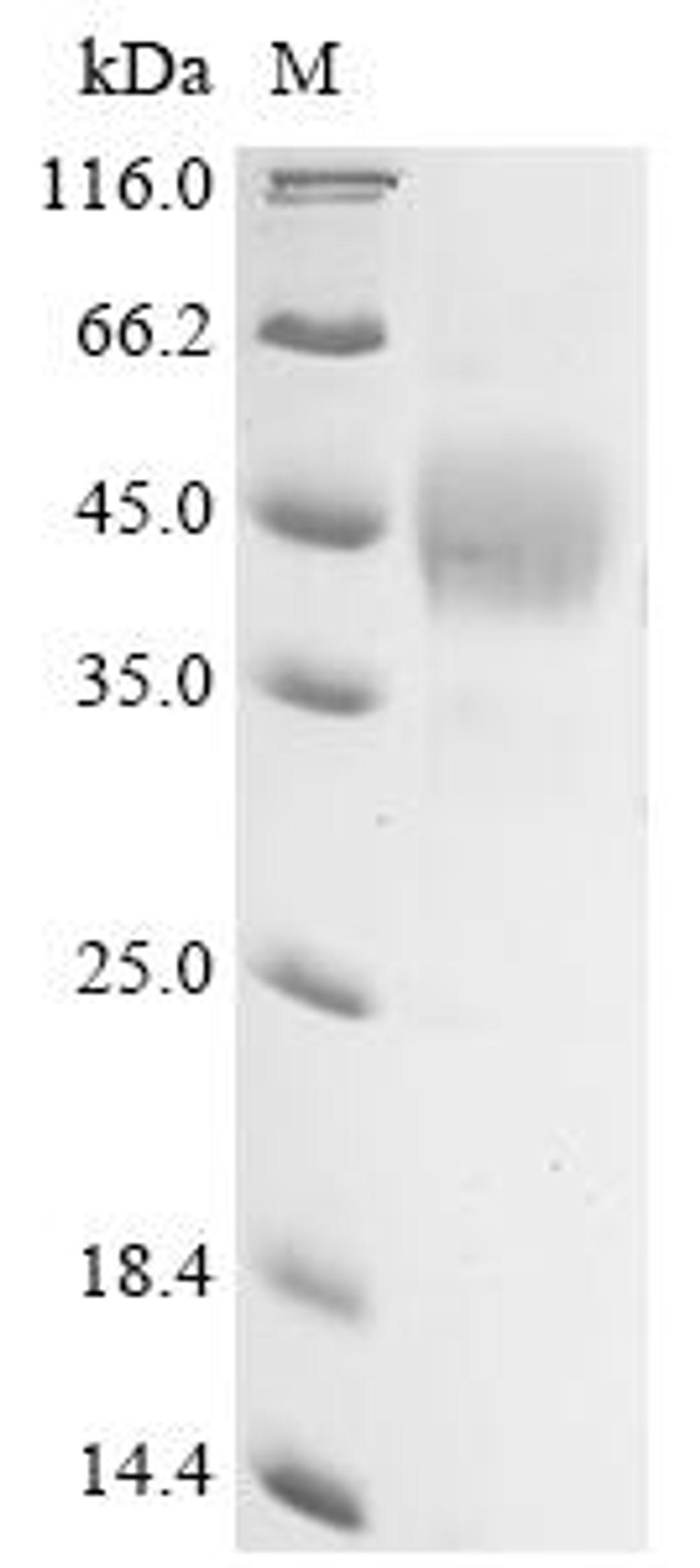 (Tris-Glycine gel) Discontinuous SDS-PAGE (reduced) with 5% enrichment gel and 15% separation gel.