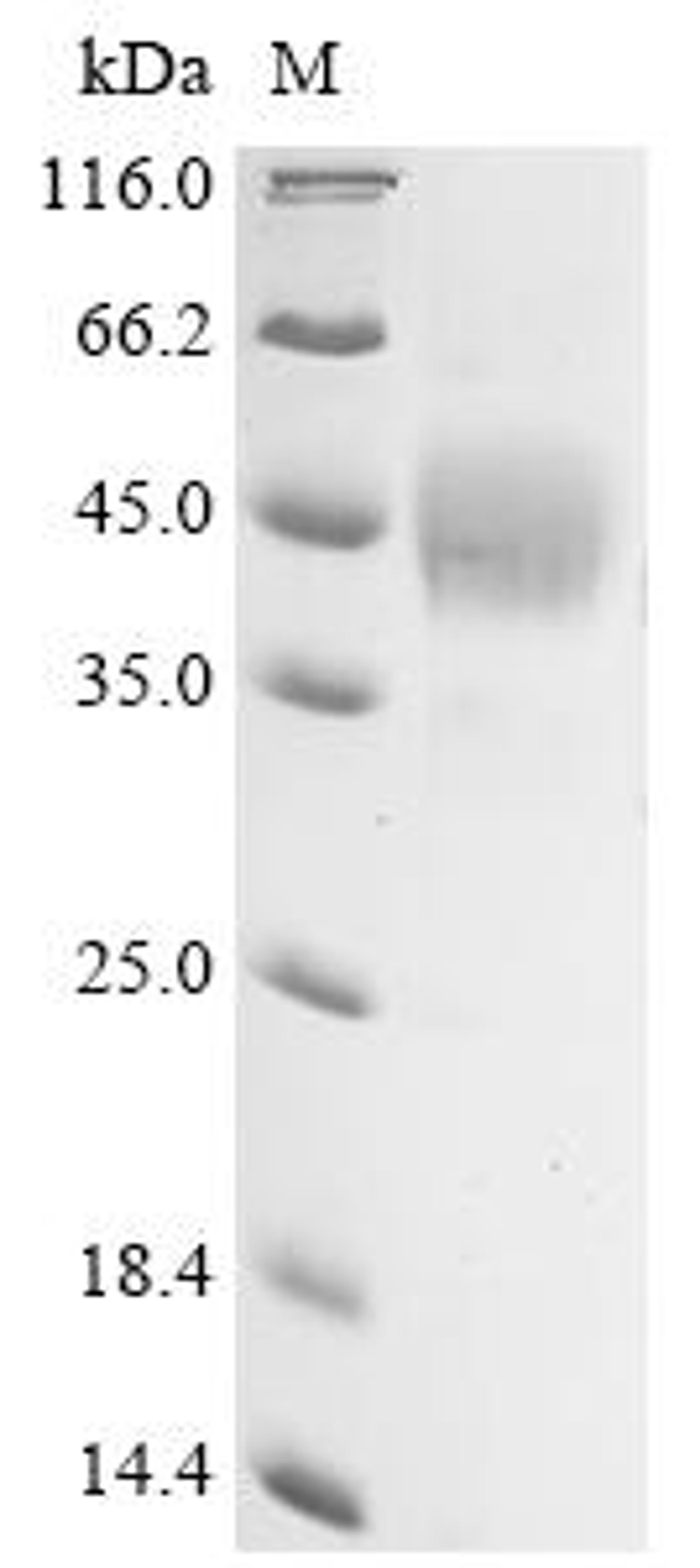 (Tris-Glycine gel) Discontinuous SDS-PAGE (reduced) with 5% enrichment gel and 15% separation gel.