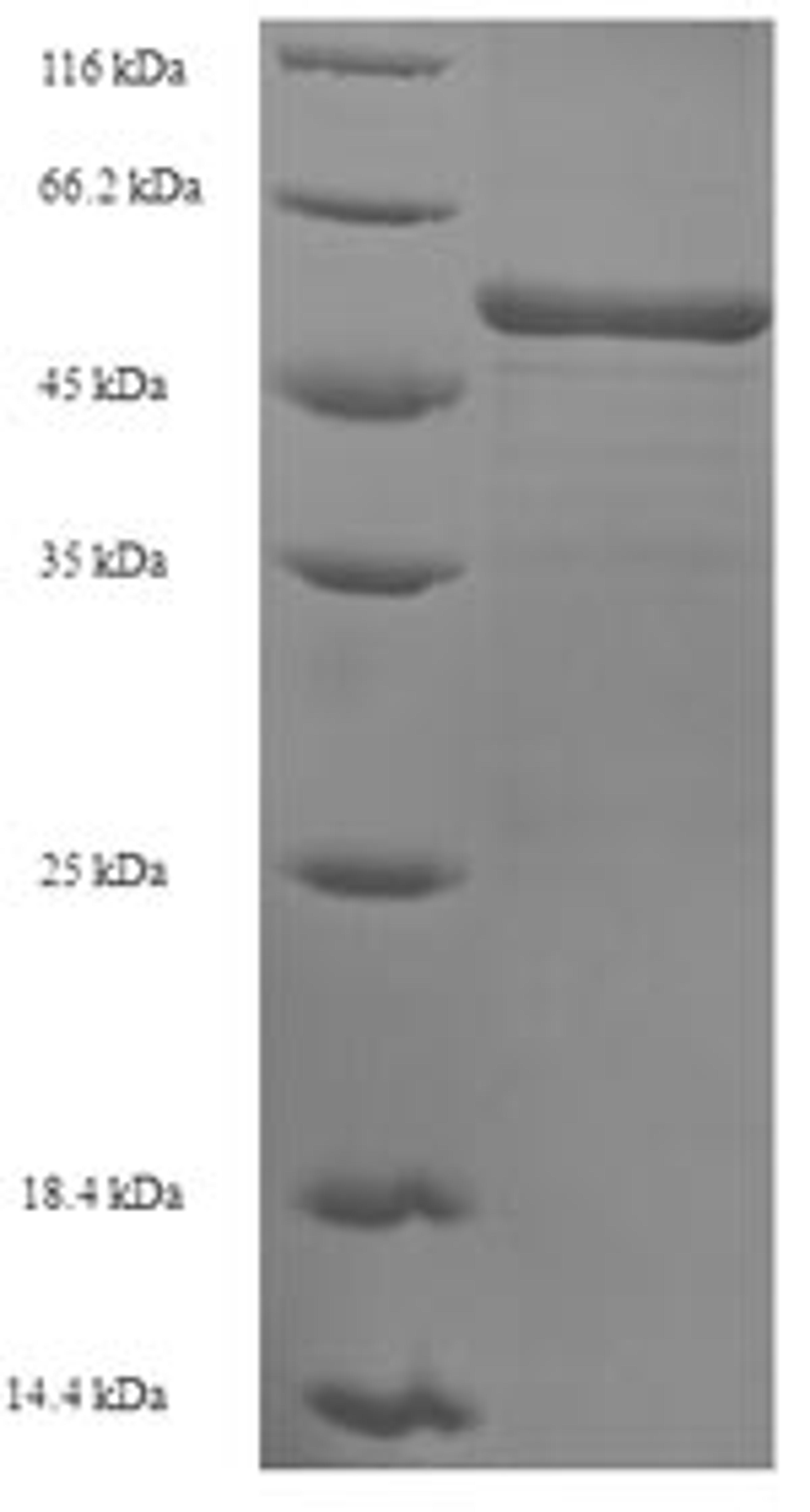 (Tris-Glycine gel) Discontinuous SDS-PAGE (reduced) with 5% enrichment gel and 15% separation gel.