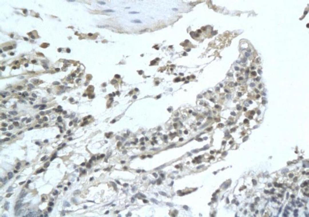 Immunohistochemical analysis of formalin-fixed paraffin embedded rat pancreatic cancer tissue using GLP1 antibody