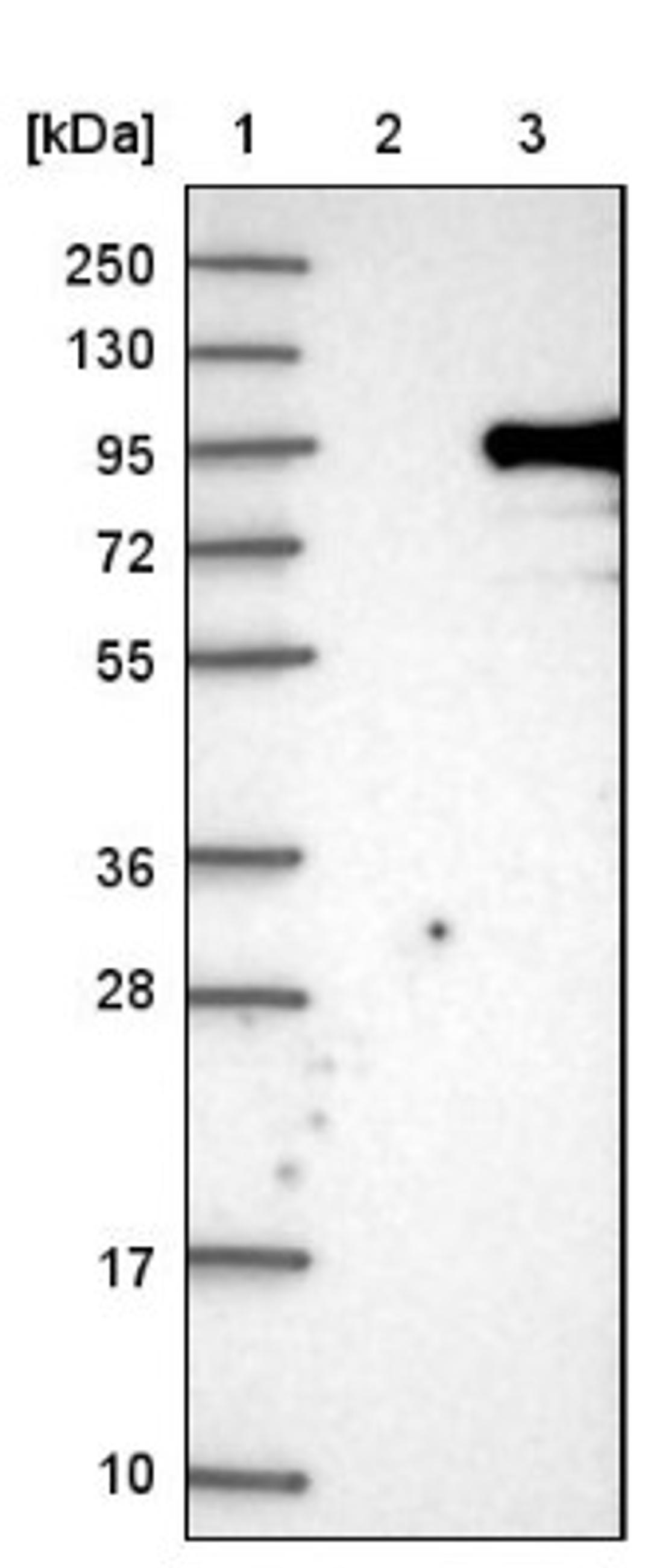 Western Blot: KIAA1586 Antibody [NBP1-86291] - Lane 1: Marker [kDa] 250, 130, 95, 72, 55, 36, 28, 17, 10<br/>Lane 2: Negative control (vector only transfected HEK293T lysate)<br/>Lane 3: Over-expression lysate (Co-expressed with a C-terminal myc-DDK tag (~3.1 kDa) in mammalian HEK293T cells, LY412227)