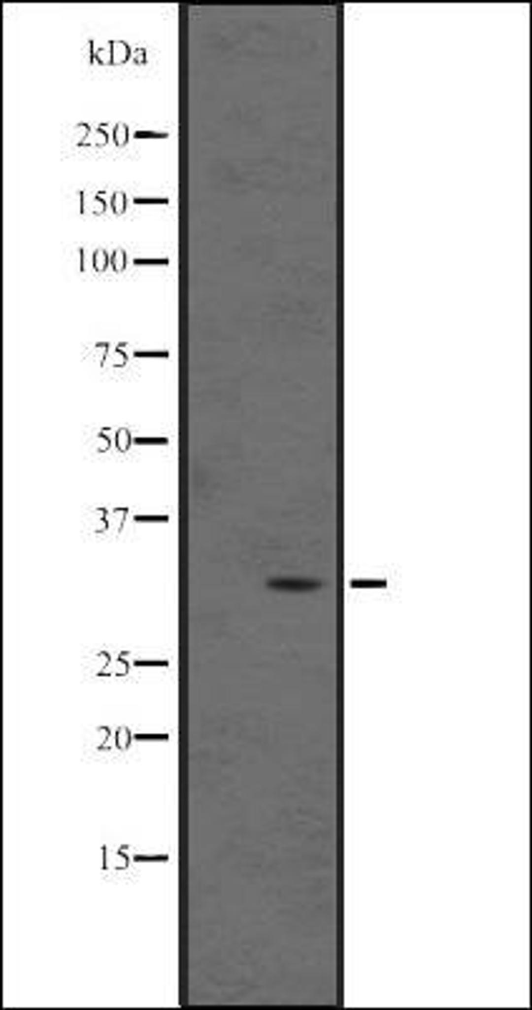 Western blot analysis of Human fetal liver lysate using MAGEB5 antibody