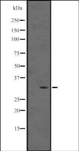 Western blot analysis of Human fetal liver lysate using MAGEB5 antibody