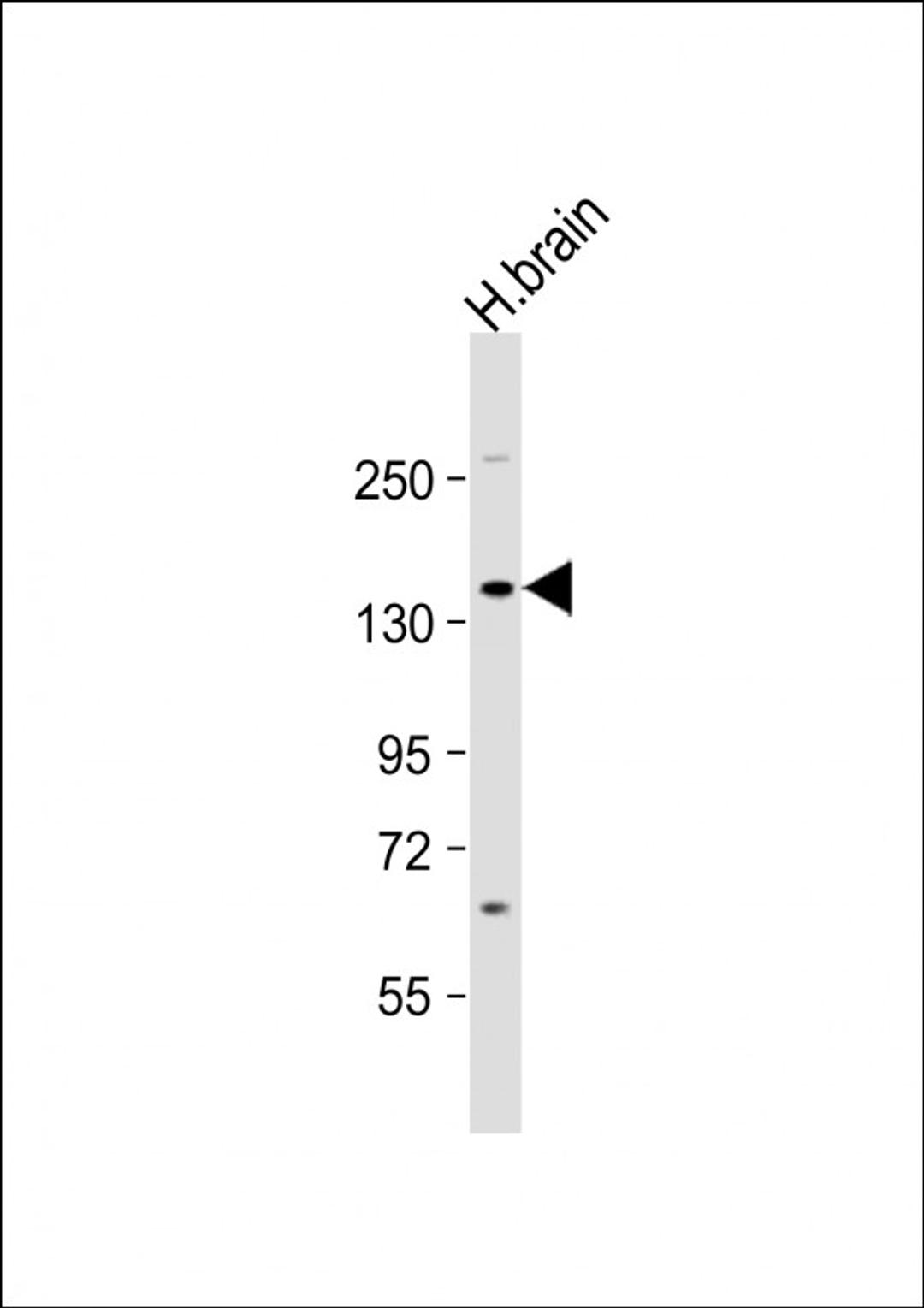 Western Blot at 1:1000 dilution + human brain lysate Lysates/proteins at 20 ug per lane.