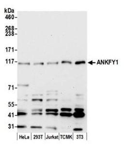 Detection of human and mouse ANKFY1 by western blot.