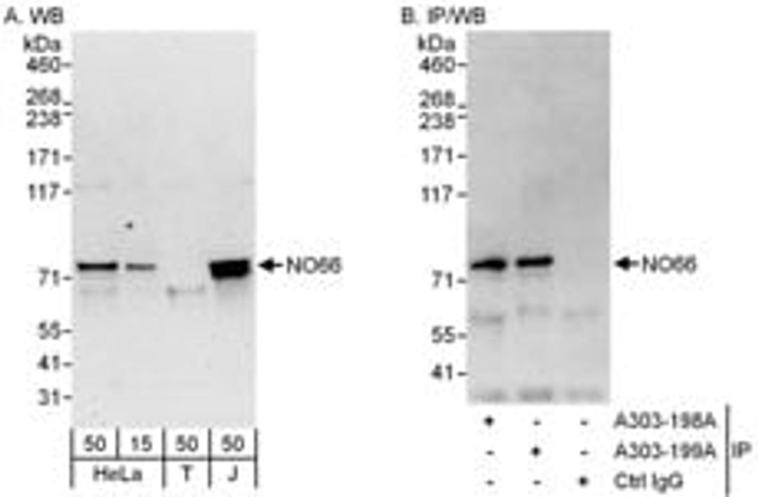 Detection of human NO66 by western blot and immunoprecipitation.