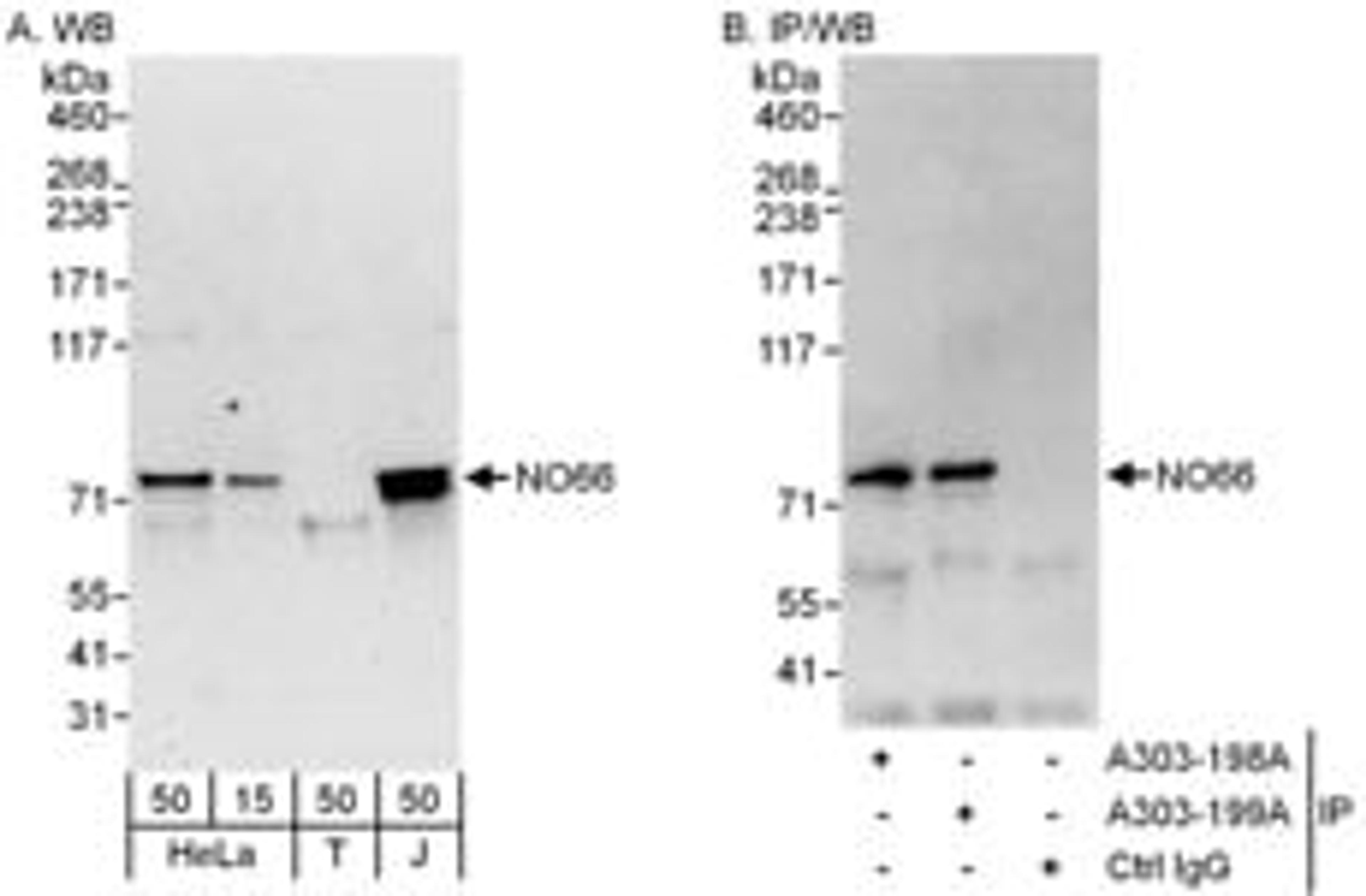 Detection of human NO66 by western blot and immunoprecipitation.