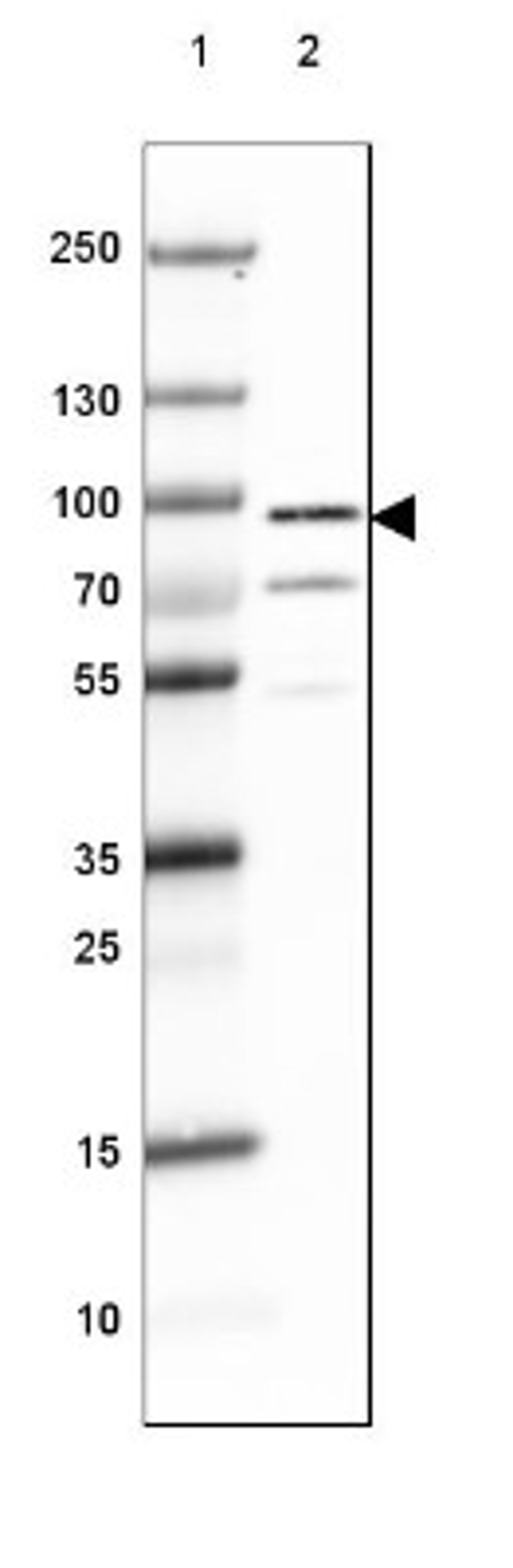 Western Blot: DPP6 Antibody [NBP2-47481] - Lane 1: Marker [kDa] 250, 130, 100, 70, 55, 35, 25, 15, 10.  Lane 2: Human Cerebral Cortex tissue