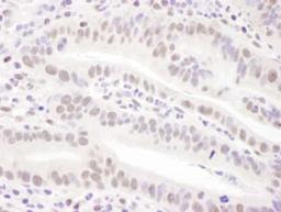 Detection of human PRPF31 by immunohistochemistry.