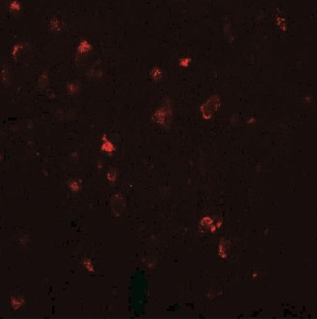 Immunocytochemistry/Immunofluorescence: LMX1A Antibody [NBP2-41193] - Immunofluorescence of LMX1A in human brain tissue with LMX1A antibody at 20 ug/mL.