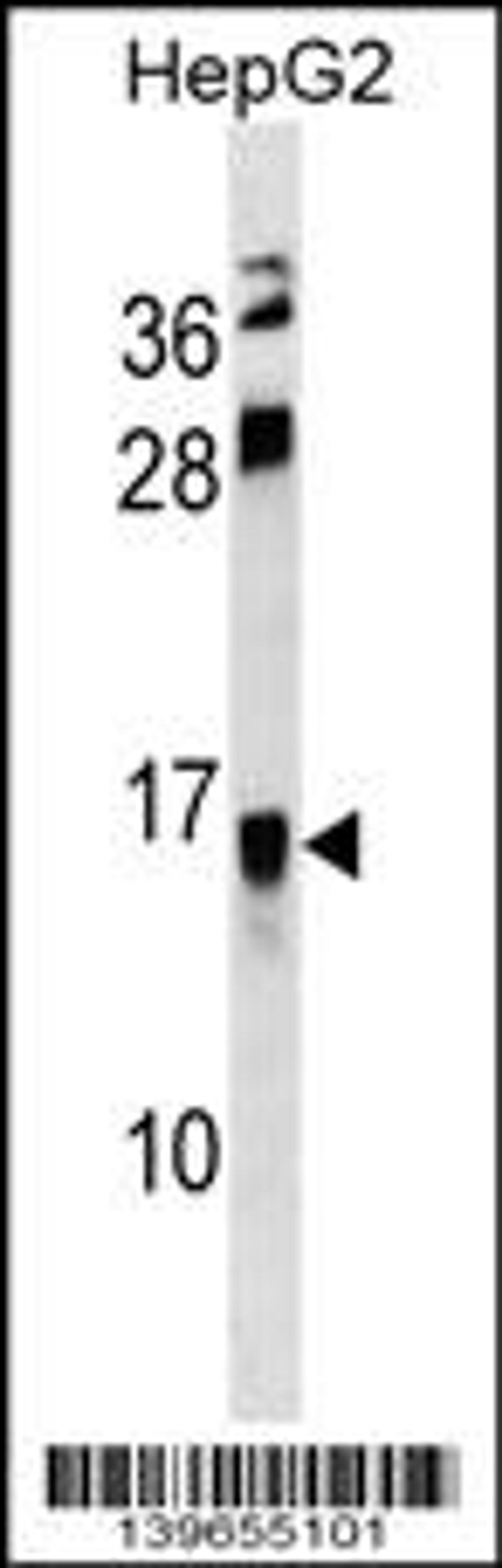 Western blot analysis in HepG2 cell line lysates (35ug/lane).