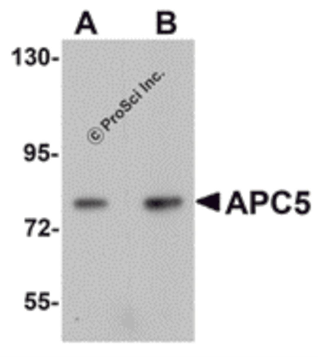 Western blot analysis of APC5 in human kidney tissue lysate with APC5 antibody at (A) 1 and (B) 2 &#956;g/mL.